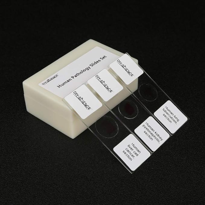 Prepared Human Pathology Microscope Slide Set, 12pcs Research-Quality Prepared Tissue Microscope Slides of Human Diseases (Human Pathology)
